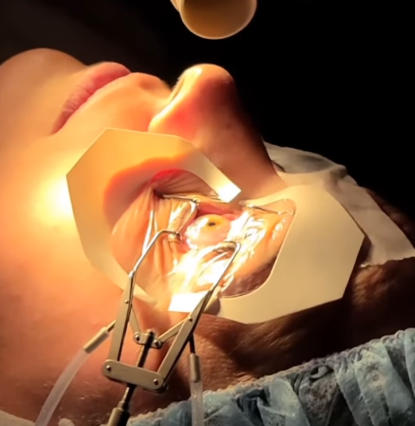 Houston Lasik & Eye, Houston, Texas